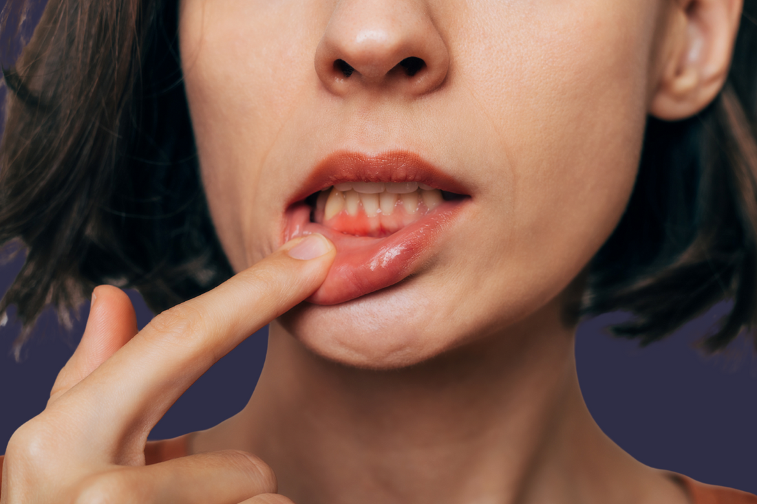 Gum Care Awareness: How Autobrush Protects Your Gums