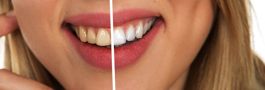 Half yellow, half whitened smile, for AutoBrush