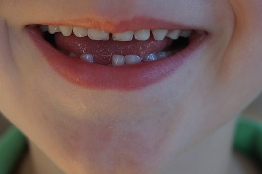 Smiling kid showing missing tooth, for AutoBrush