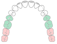 diagram of teeth for small brush heads