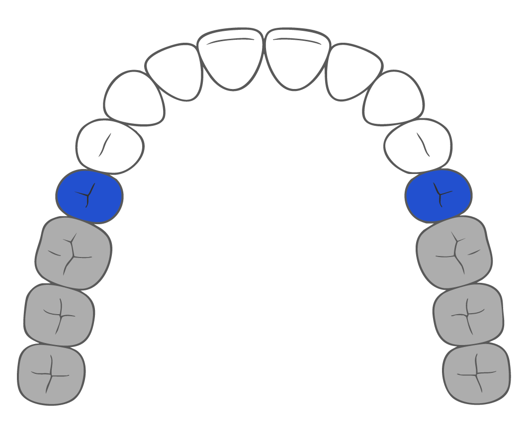 diagram of teeth for small brush heads