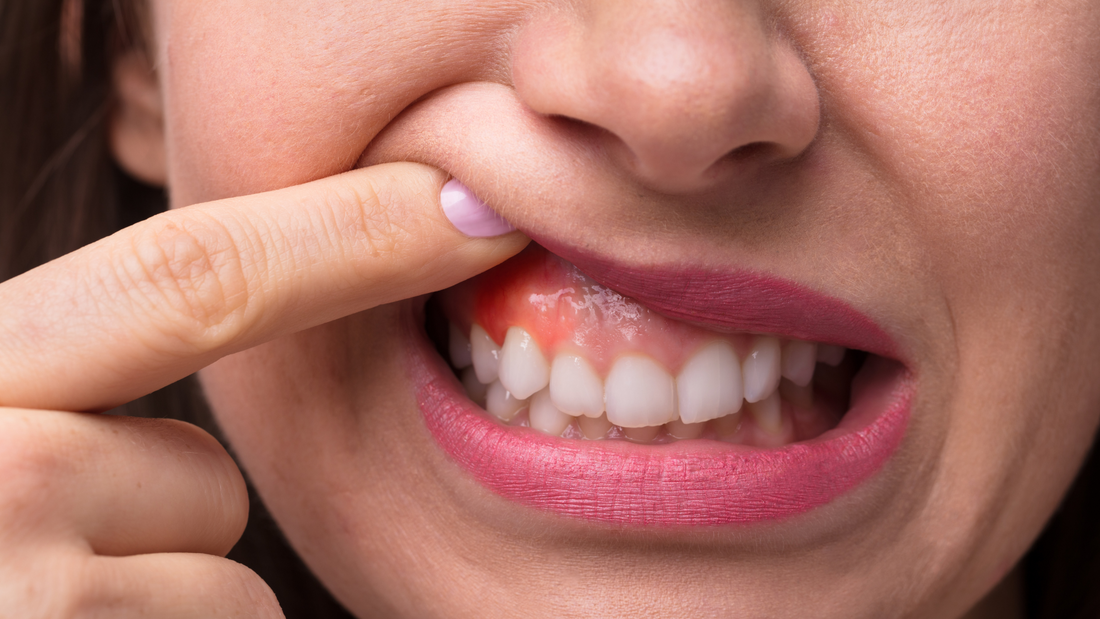 Is Aggressive Brushing Ruining Your Gums?