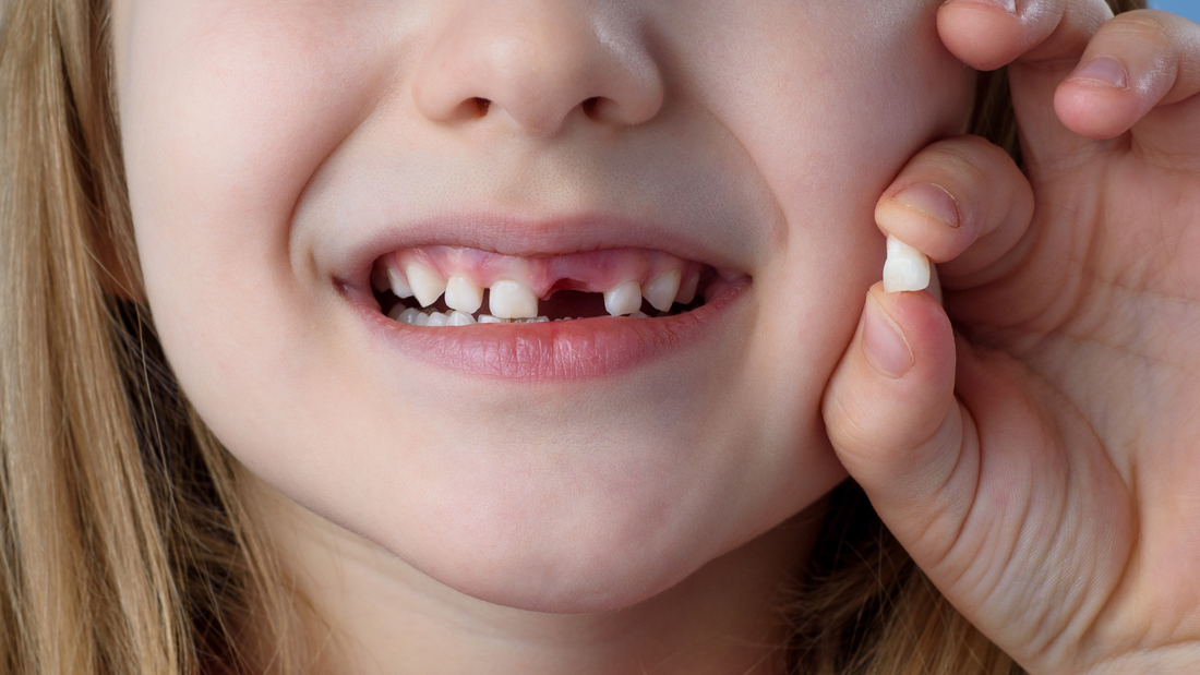 What to Do When Your Child Has a Loose Tooth