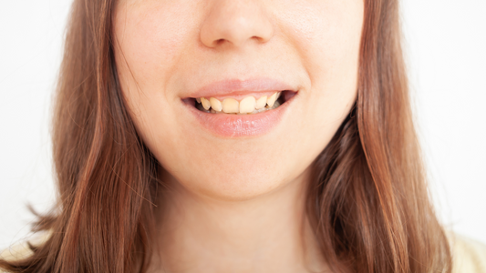 Say Goodbye to Yellow Teeth: A Complete Guide to Achieving a Bright Smile
