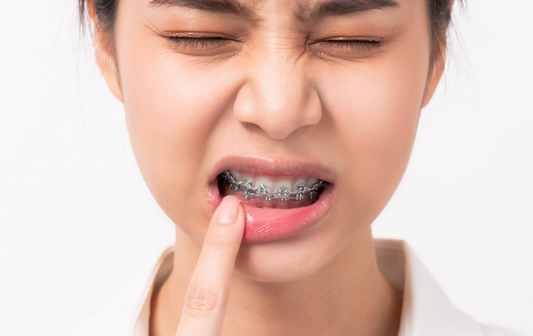 Keeping Your Breath Fresh While Wearing Braces