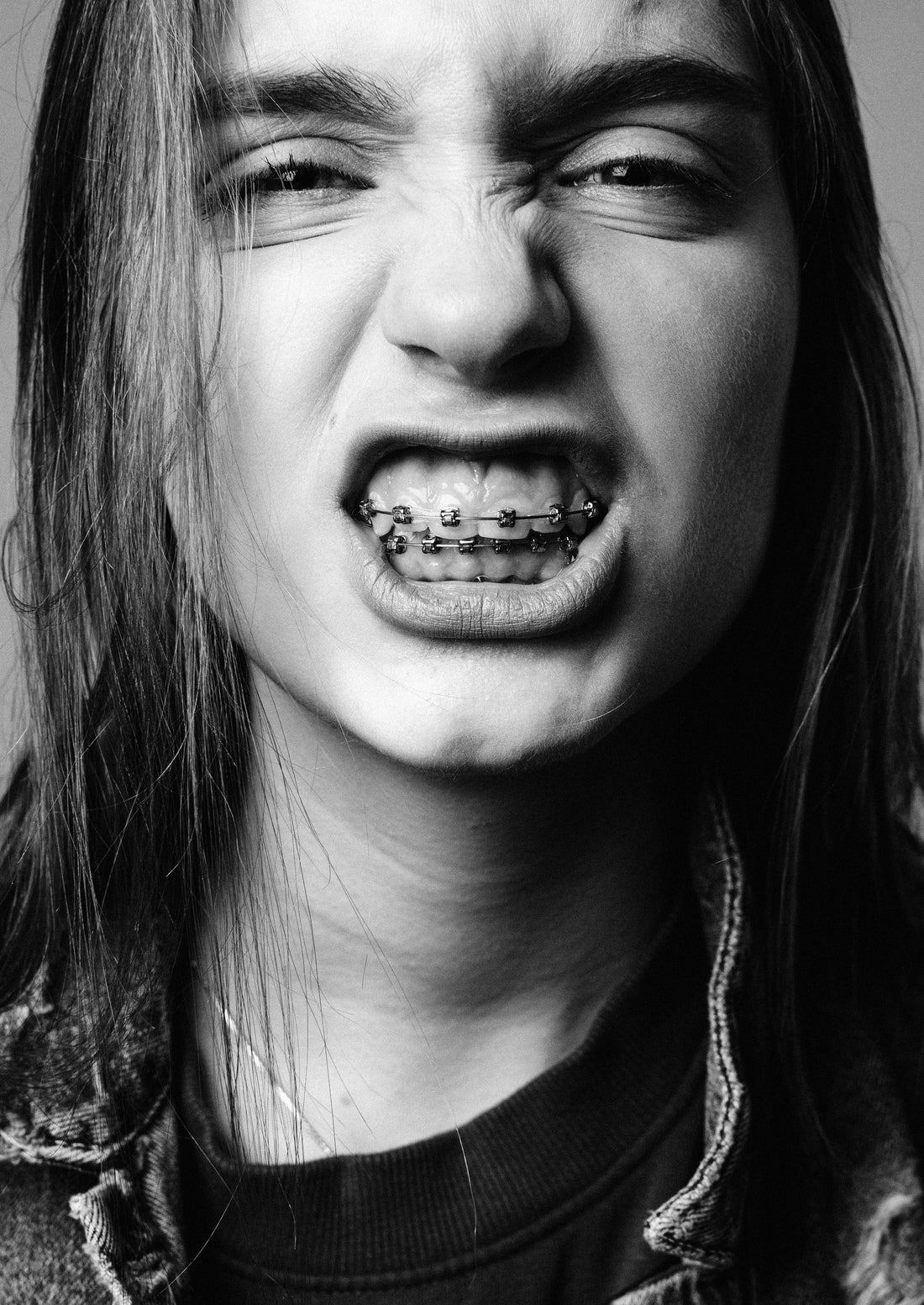 Long haired girl with braces showing off her teeth, for AutoBrush