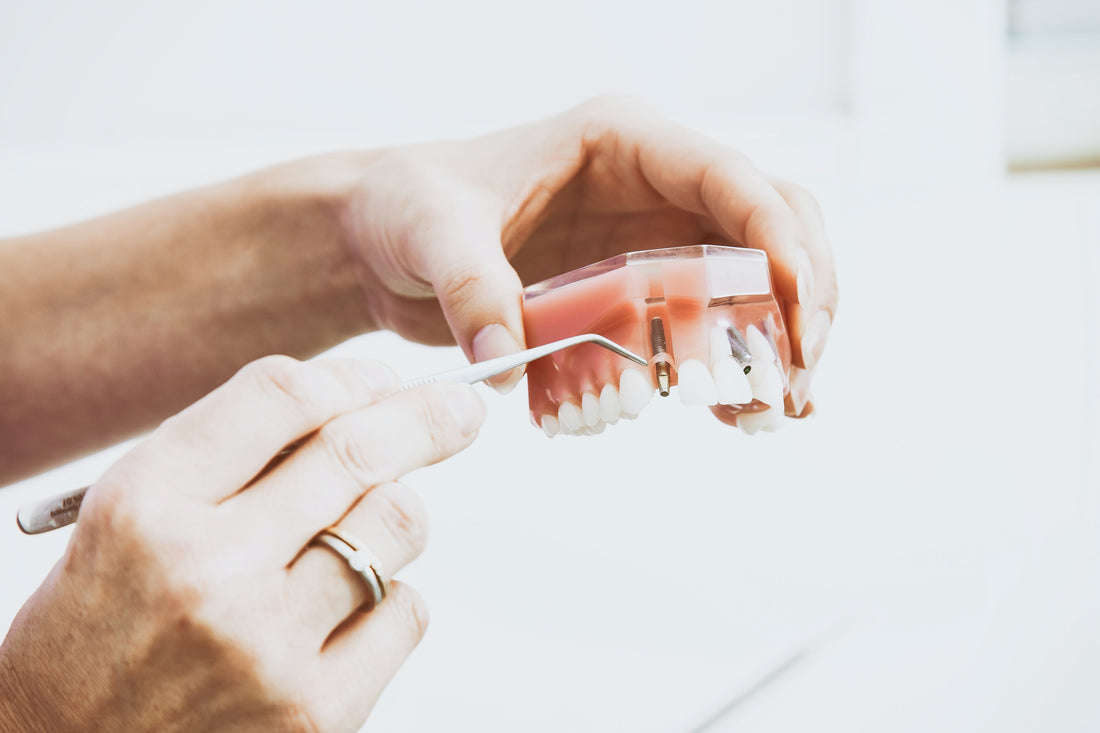 Why Wisdom Teeth Need To Be Extracted?