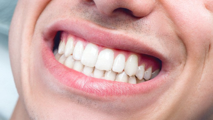 Smiling white teeth