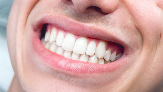 Smiling white teeth