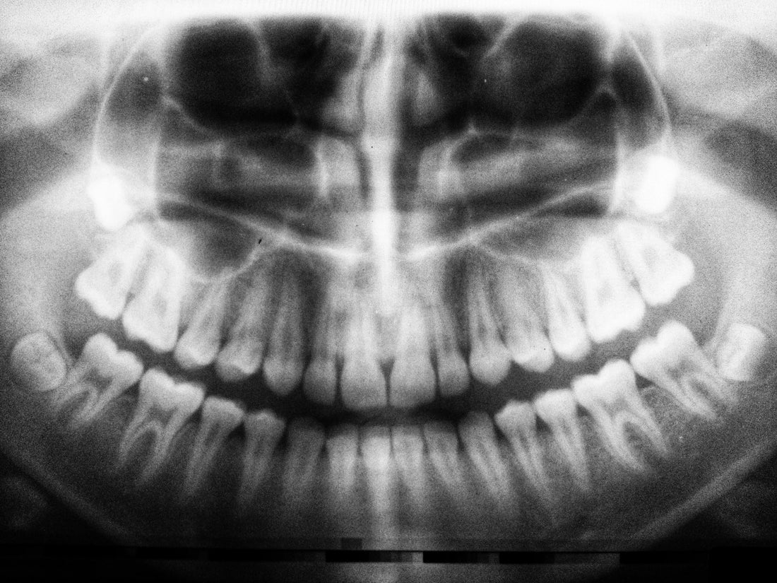 X-ray image of the human teeth, for AutoBrush