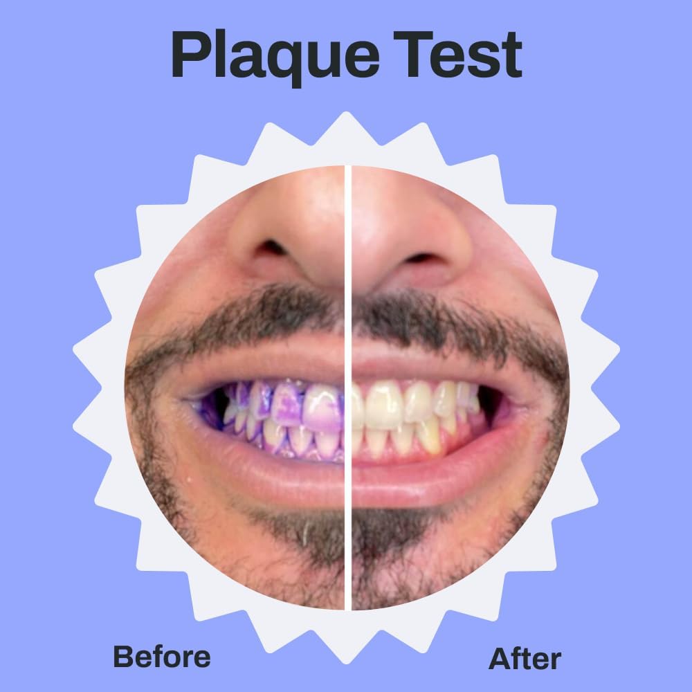 Autobrush® Sonic Pro - 1 Pack