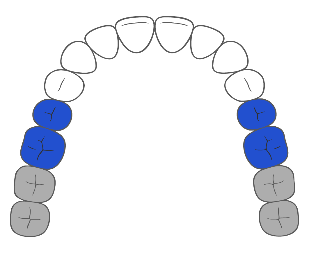 diagram of teeth for small brush heads