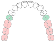 diagram of teeth for small brush heads