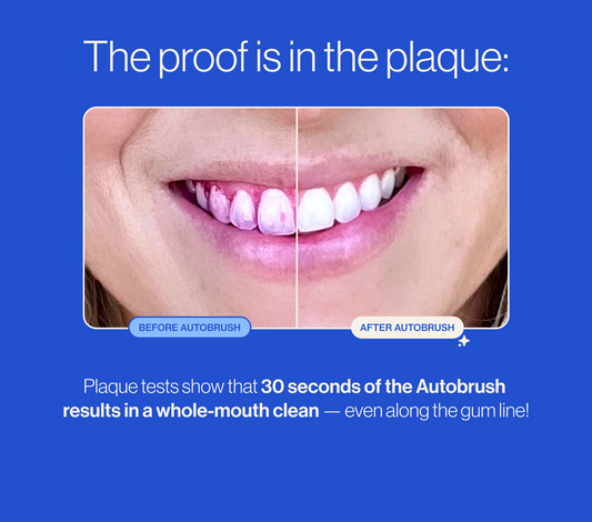 Before and after comparison of teeth with plaque removal using an autobrush on a blue background. PDP context and explanatory images.
